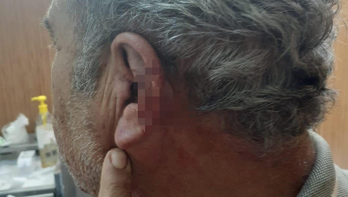 aile hekimi ile emekli ogretmenin mesai kavgasikarakolda bitti SefLwjAt